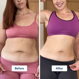 UPPER TRIM SET