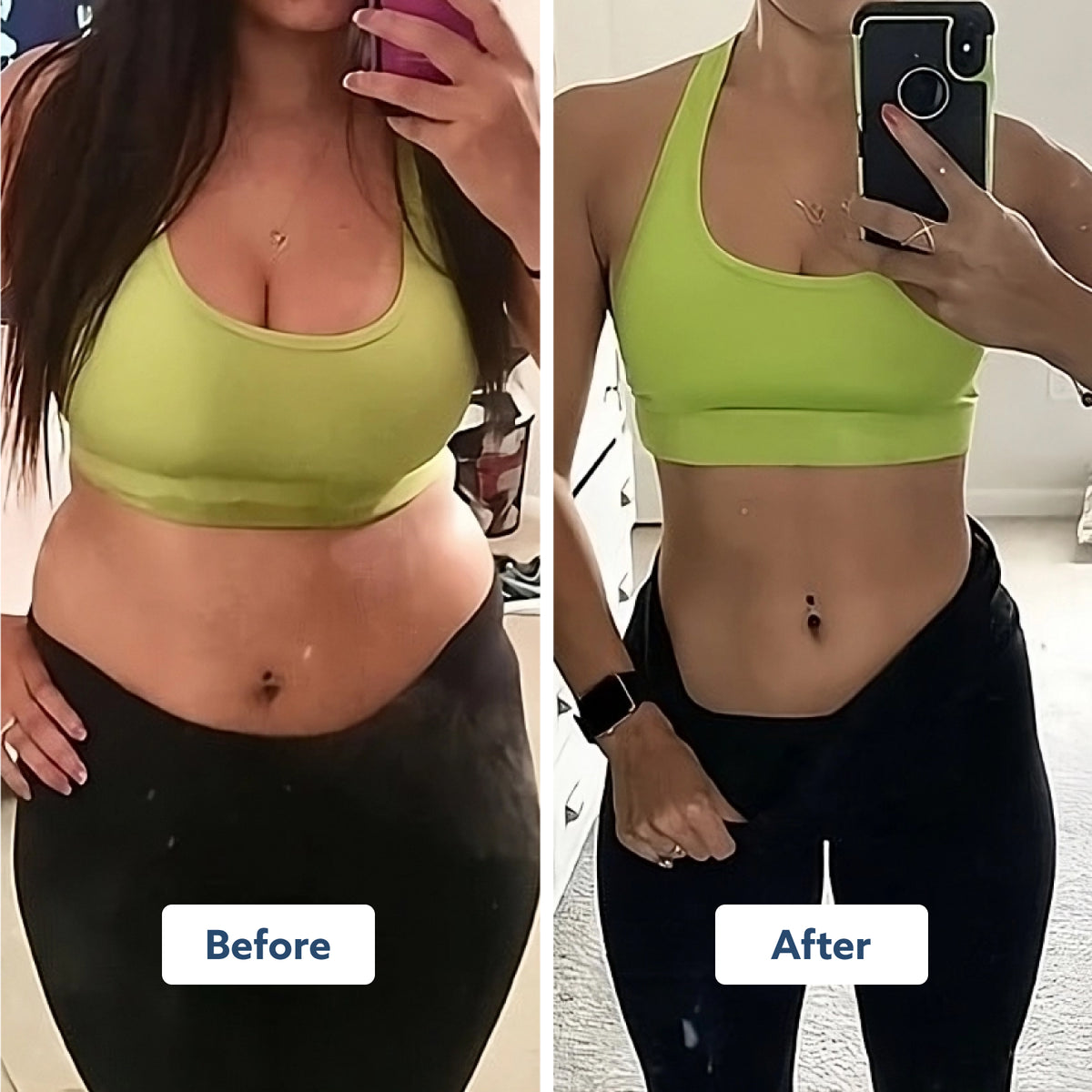 UPPER TRIM SET